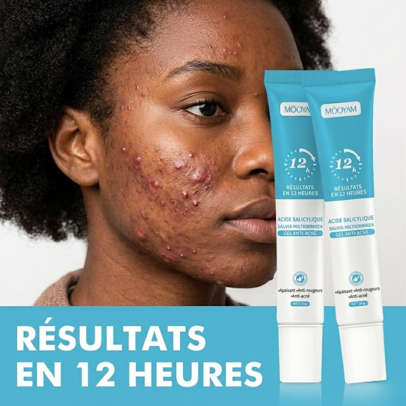 Gel Anti-Acné MOÔYAM ✨ Acide Salicylique | Élimine les boutons | Apaise & réduit les rougeurs (12H)
