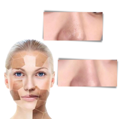 Masque Stick au Thé Vert – Nettoyage Profond & Élimination des Points Noirs